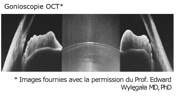 OCT revo NX130 Analyses du segment antérieur